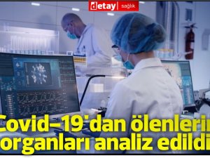 Covid-19'dan ölenlerin organları analiz edildi.Neler değişmiş?