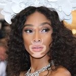 Kalıpları Yıkan Model Winnie Harlow galerisi resim 1