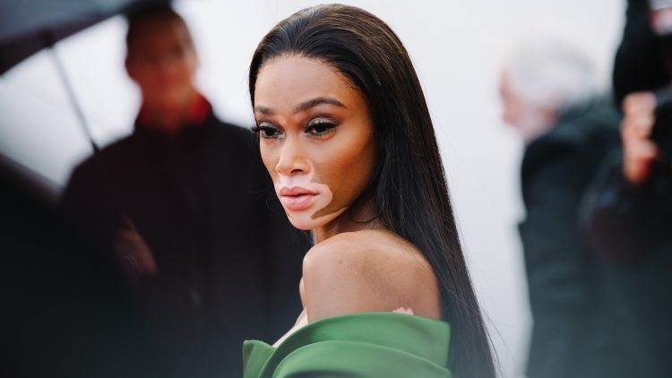 Kalıpları Yıkan Model Winnie Harlow galerisi resim 10