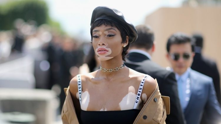 Kalıpları Yıkan Model Winnie Harlow galerisi resim 15