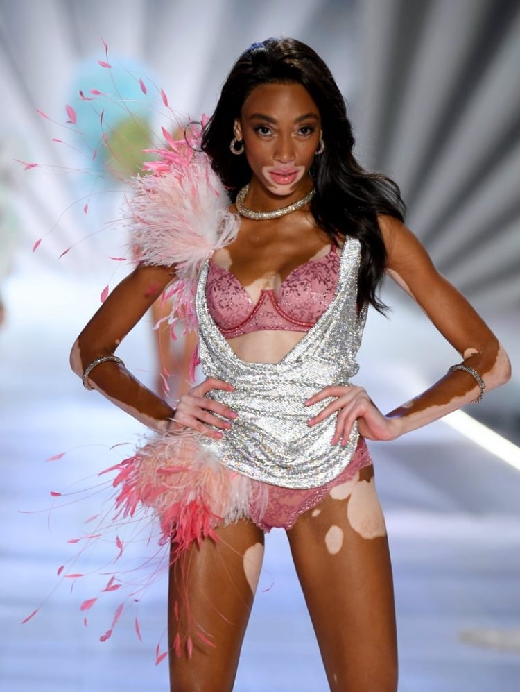 Kalıpları Yıkan Model Winnie Harlow galerisi resim 17