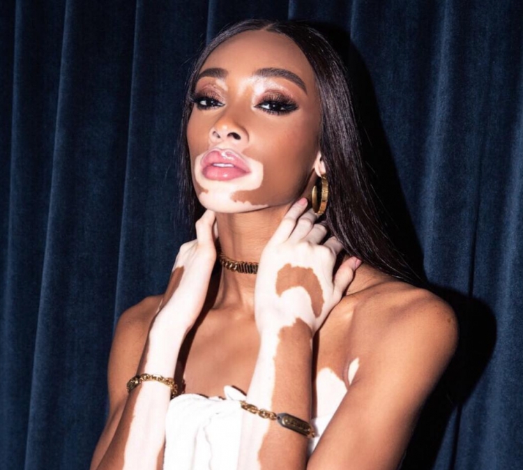 Kalıpları Yıkan Model Winnie Harlow galerisi resim 21