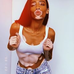 Kalıpları Yıkan Model Winnie Harlow galerisi resim 3