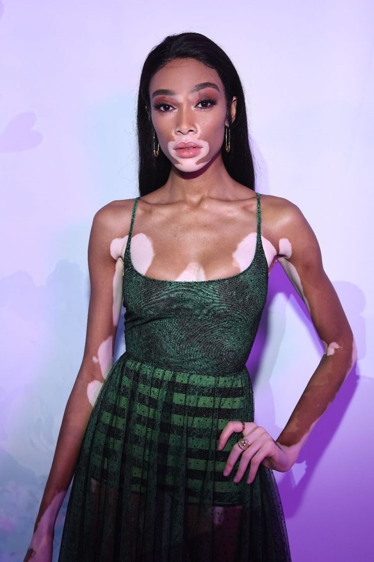 Kalıpları Yıkan Model Winnie Harlow galerisi resim 8