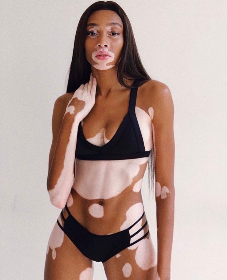 Kalıpları Yıkan Model Winnie Harlow galerisi resim 9