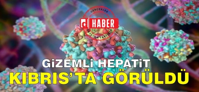 Güney Kıbrıs'taki 4 buçuk Yaşındaki Çocukta Etiyolojisi Bilinmeyen Hepatit Vakası Çıktı