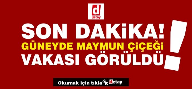 Güney Kıbrıs’ta ilk maymun çiçeği vakası saptandı