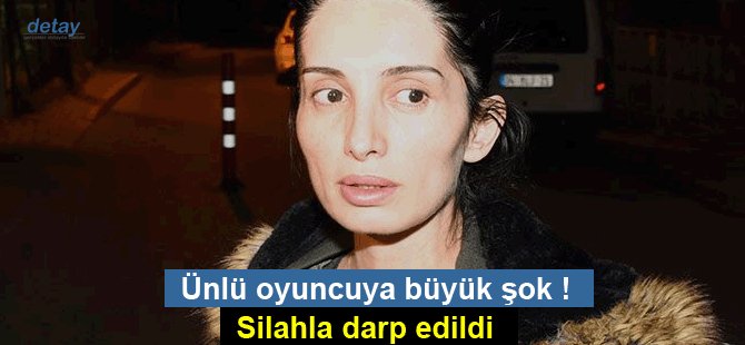 Ünlü oyuncuya büyük şok. Silahla darp edildi