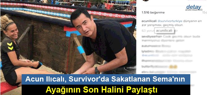 Acun Ilıcalı, Survivor'da Sakatlanan Sema'nın Ayağının Son Halini Paylaştı