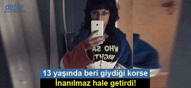 13 yaşında beri giydiği korse inanılmaz hale getirdi!