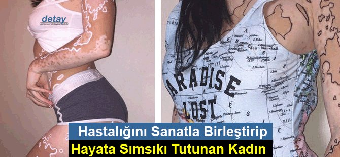 Hastalığını Sanatla Birleştirip Hayata Sımsıkı Tutunan Kadının İlham Verici Hikayesi