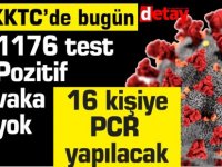 KKTC'de Tedavisi Devam Eden Vaka Sayısı 3  