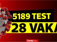 Bakan açıkladı:5189 test 28 vaka!