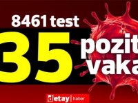 Toplam 8461 test yapıldı, 31'i yerel 35 pozitif vaka