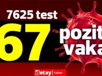 7625 test yapıldı, 55'i yerel 67 pozitif vaka