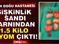 Şişkinlik Sandı Karnından 1,5 Kilo Miyom Çıktı