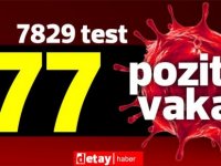 7829  test yapıldı, 58'i yerel 77 pozitif vaka