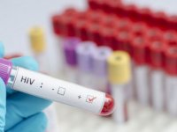 Nijerya’da 1,8 milyon kişi AIDS