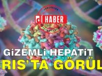 Güney Kıbrıs'taki 4 buçuk Yaşındaki Çocukta Etiyolojisi Bilinmeyen Hepatit Vakası Çıktı