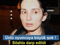 Ünlü oyuncuya büyük şok. Silahla darp edildi