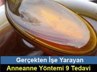 Gerçekten İşe Yarayan Anneanne Yöntemi 9 Tedavi