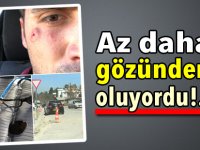 Az daha gözünden oluyordu!..